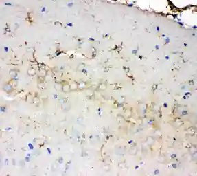 Anti-PMP70 antibody used in IHC (Paraffin sections) (IHC-P). GTX12314
