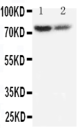 Anti-PMP70 antibody used in Western Blot (WB). GTX12314