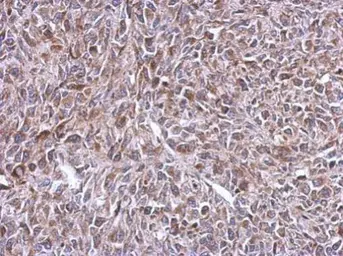 Anti-MRPL14 antibody used in IHC (Paraffin sections) (IHC-P). GTX123143
