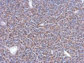 Anti-MRPL14 antibody used in IHC (Paraffin sections) (IHC-P). GTX123143