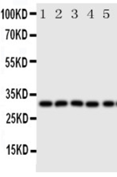 Anti-Aquaporin 9 antibody used in Western Blot (WB). GTX12315