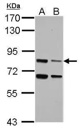 Anti-LSG1 antibody used in Western Blot (WB). GTX123155