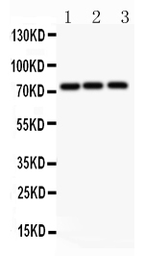 Anti-APLP1 antibody used in Western Blot (WB). GTX12316