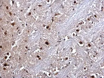 Anti-RED antibody used in IHC (Paraffin sections) (IHC-P). GTX123169