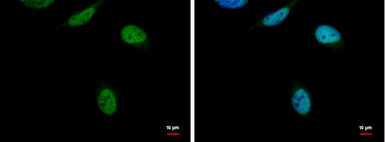 Anti-RED antibody used in Immunocytochemistry/ Immunofluorescence (ICC/IF). GTX123170