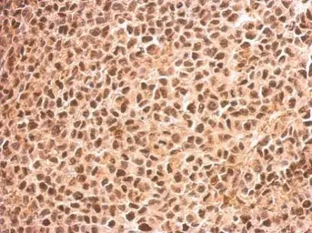 Anti-RED antibody used in IHC (Paraffin sections) (IHC-P). GTX123170