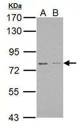 Anti-RED antibody used in Western Blot (WB). GTX123170
