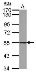 Anti-ATL3 antibody used in Western Blot (WB). GTX123176