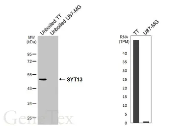 Anti-SYT13 antibody used in Western Blot (WB). GTX123188