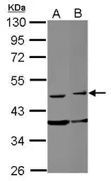 Anti-FAM98B antibody used in Western Blot (WB). GTX123191