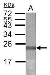 Anti-LONP2 antibody used in Western Blot (WB). GTX123193
