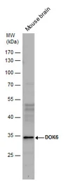 Anti-DOK6 antibody used in Western Blot (WB). GTX123195