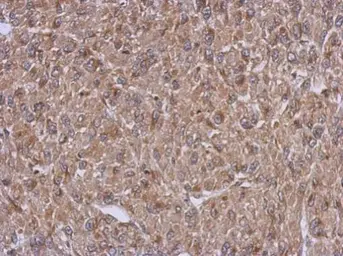 Anti-ARFIP1 antibody used in IHC (Paraffin sections) (IHC-P). GTX123214