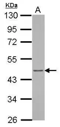 Anti-ARFIP1 antibody used in Western Blot (WB). GTX123214