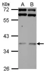 Anti-DNAJB7 antibody used in Western Blot (WB). GTX123260