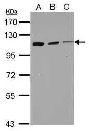 Anti-Coronin 7 antibody used in Western Blot (WB). GTX123282