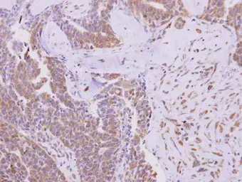 Anti-KBTBD3 antibody used in IHC (Paraffin sections) (IHC-P). GTX123289