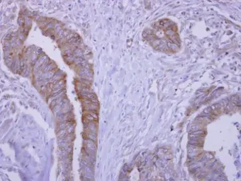 Anti-SLA/LP antibody used in IHC (Paraffin sections) (IHC-P). GTX123307