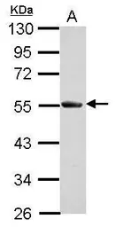 Anti-SLA/LP antibody used in Western Blot (WB). GTX123307