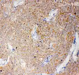 Anti-Caspase 12 antibody used in IHC (Paraffin sections) (IHC-P). GTX12333