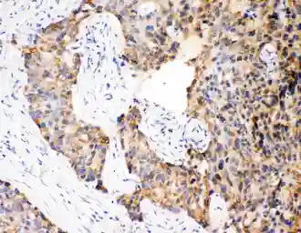 Anti-Caspase 12 antibody used in IHC (Paraffin sections) (IHC-P). GTX12333