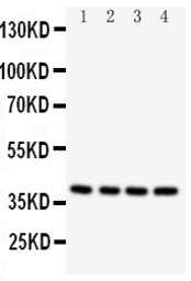 Anti-Caspase 12 antibody used in Western Blot (WB). GTX12333