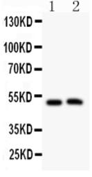 Anti-Aquaporin 0 antibody used in Western Blot (WB). GTX12335