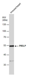 Anti-PRELP antibody used in Western Blot (WB). GTX123359