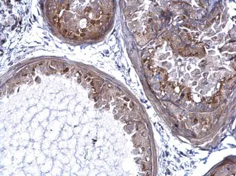 Anti-PRELP antibody used in IHC (Paraffin sections) (IHC-P). GTX123359