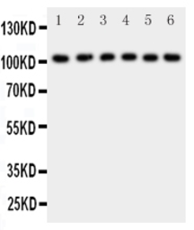 Anti-NFkB p105 antibody used in Western Blot (WB). GTX12337