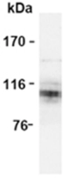 Anti-APP antibody [3E9] used in Western Blot (WB). GTX12338