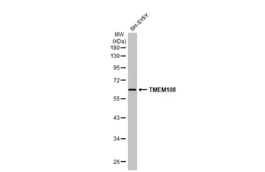 Anti-TMEM108 antibody used in Western Blot (WB). GTX123412