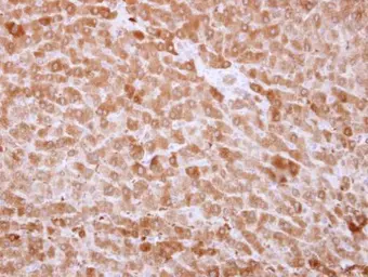Anti-ALDH1A1 antibody used in IHC (Paraffin sections) (IHC-P). GTX123427