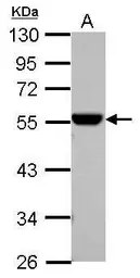 Anti-ALDH1A1 antibody used in Western Blot (WB). GTX123427