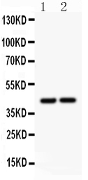 Anti-RUNX3 antibody used in Western Blot (WB). GTX12343