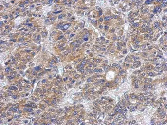 Anti-Casein Kinase 1 delta antibody used in IHC (Paraffin sections) (IHC-P). GTX123435