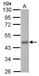 Anti-Casein Kinase 1 delta antibody used in Western Blot (WB). GTX123435