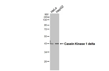 Anti-Casein Kinase 1 delta antibody used in Western Blot (WB). GTX123435