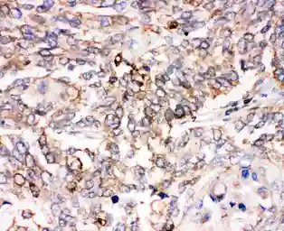 Anti-Smad1 antibody used in IHC (Paraffin sections) (IHC-P). GTX12344