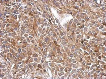 Anti-OXSM antibody used in IHC (Paraffin sections) (IHC-P). GTX123463