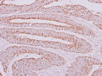 Anti-OXSM antibody used in IHC (Paraffin sections) (IHC-P). GTX123464