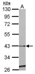 Anti-SERPINE2 antibody used in Western Blot (WB). GTX123522