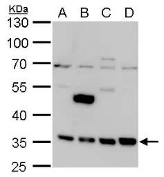 Anti-LRRC59 antibody used in Western Blot (WB). GTX123532