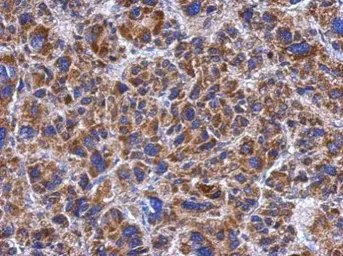 Anti-TSARG2 antibody used in IHC (Paraffin sections) (IHC-P). GTX123559
