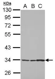 Anti-TSARG2 antibody used in Western Blot (WB). GTX123559