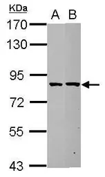 Anti-ESRP2 antibody used in Western Blot (WB). GTX123665