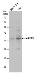 Anti-ZNF486 antibody used in Western Blot (WB). GTX123668