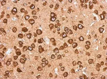 Anti-SEC6 antibody used in IHC (Paraffin sections) (IHC-P). GTX123688