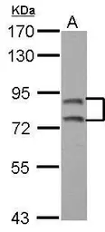 Anti-SEC6 antibody used in Western Blot (WB). GTX123688