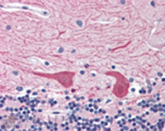Anti-Syntaxin 2 antibody used in Immunohistochemistry (IHC). GTX12369